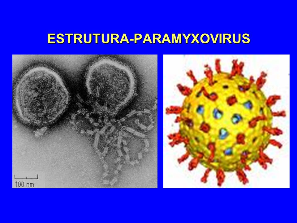 Resultado de imagem para paramyxovirus caxumba