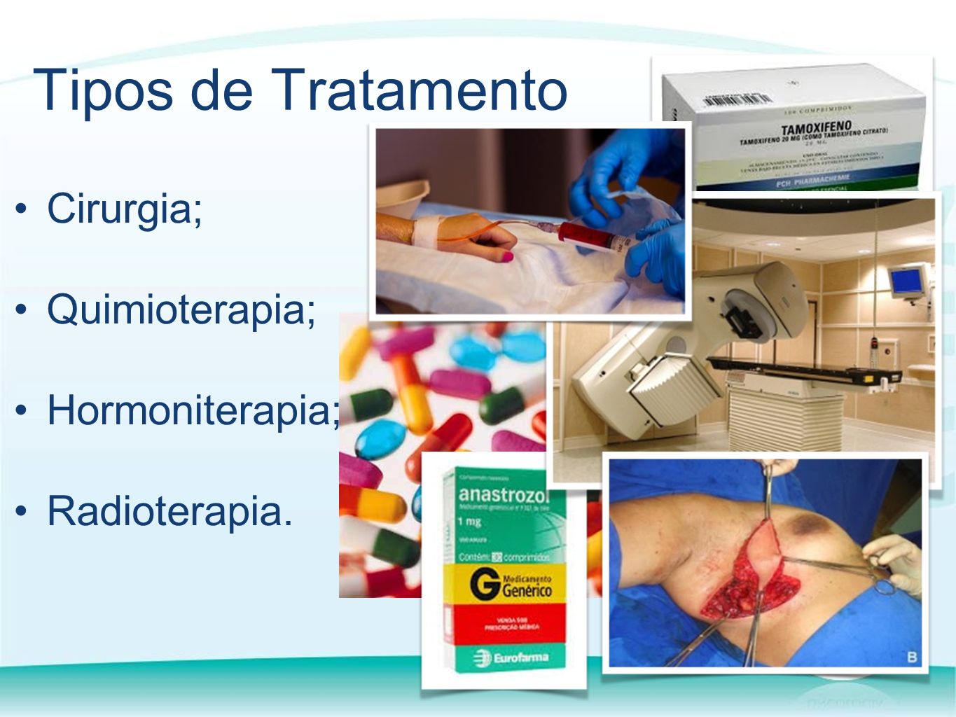 Tipos de Tratamento Cirurgia; Quimioterapia; Hormoniterapia; Radioterapia.