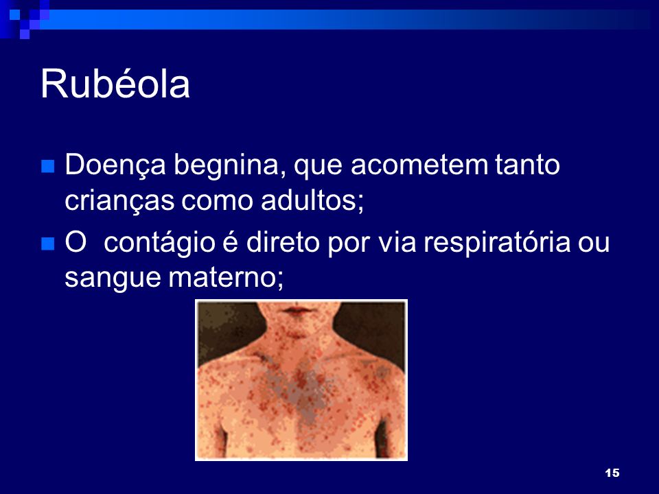 15 Rubéola Doença begnina, que acometem tanto crianças como adultos; O contágio é direto por via respiratória ou sangue materno;