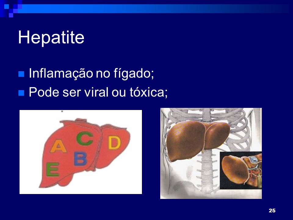 25 Hepatite Inflamação no fígado; Pode ser viral ou tóxica;