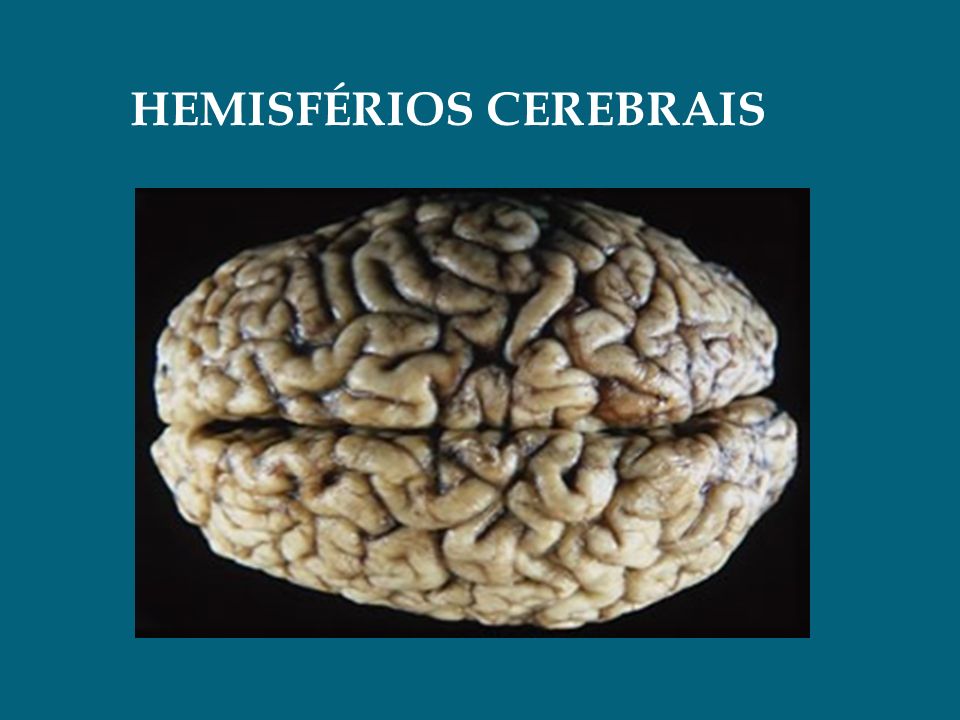 HEMISFÉRIOS CEREBRAIS