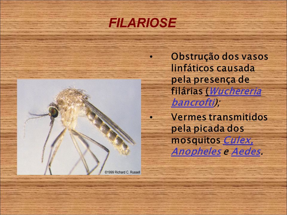 FILARIOSE Obstrução dos vasos linfáticos causada pela presença de filárias (Wuchereria bancrofti); Vermes transmitidos pela picada dos mosquitos Culex, Anopheles e Aedes.