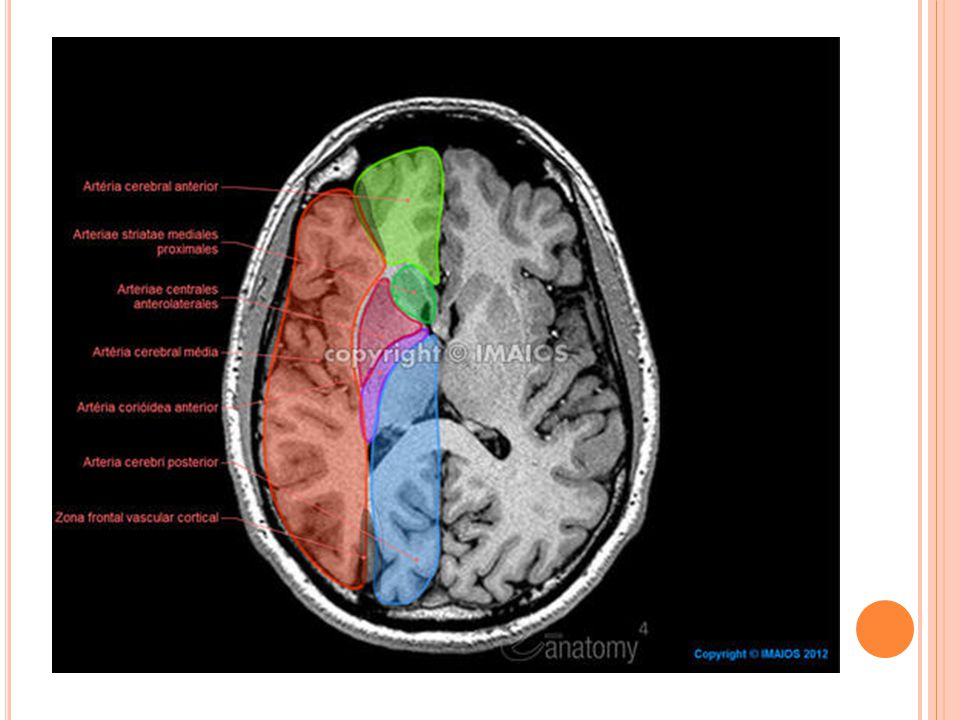 Доли мозга мрт. Границы долей головного мозга на кт. Доли головного мозга на кт анатомия. Мрт головного мозга аксиальный срез.